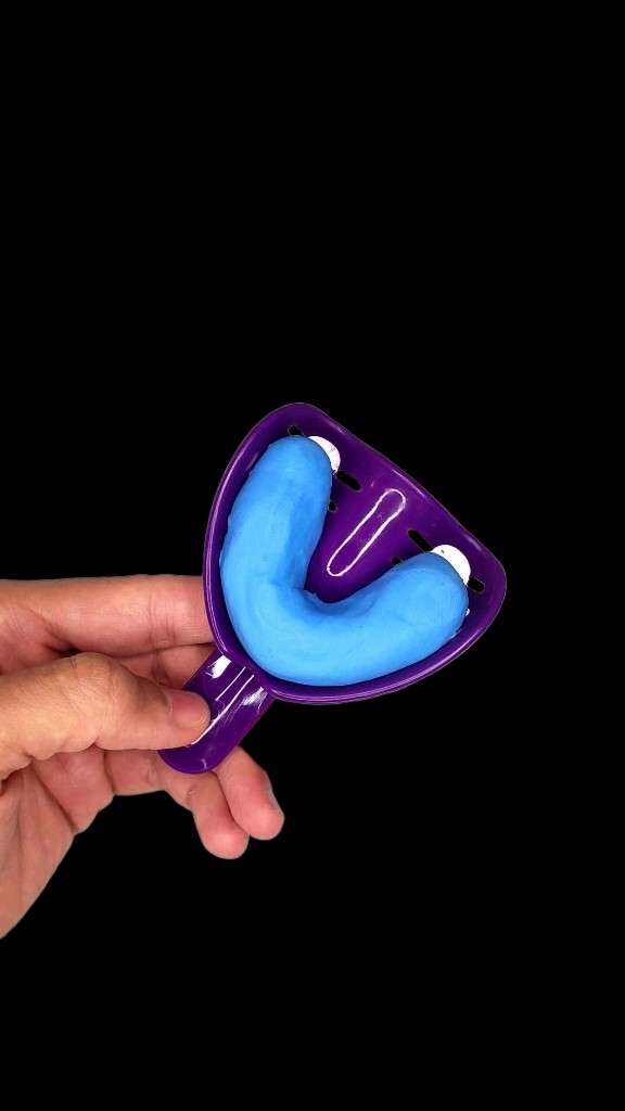 Boudin de silicone placé dans le porte-empreinte