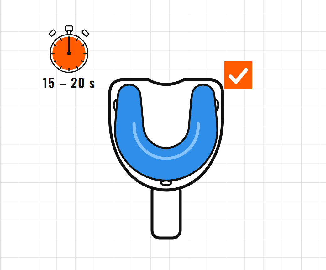 Blue silicone roll placed in the impression tray, timer set to 15 to 20 seconds