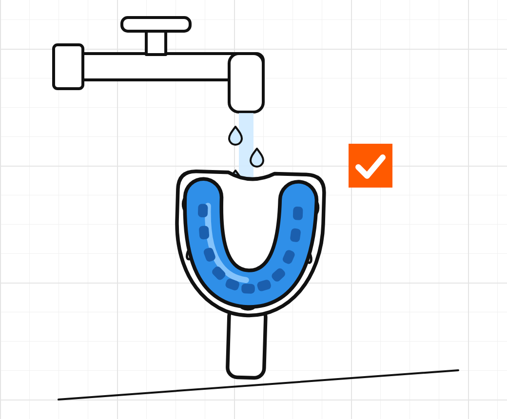Impression rinsed under cold water: every tooth is marked in the blue silicone